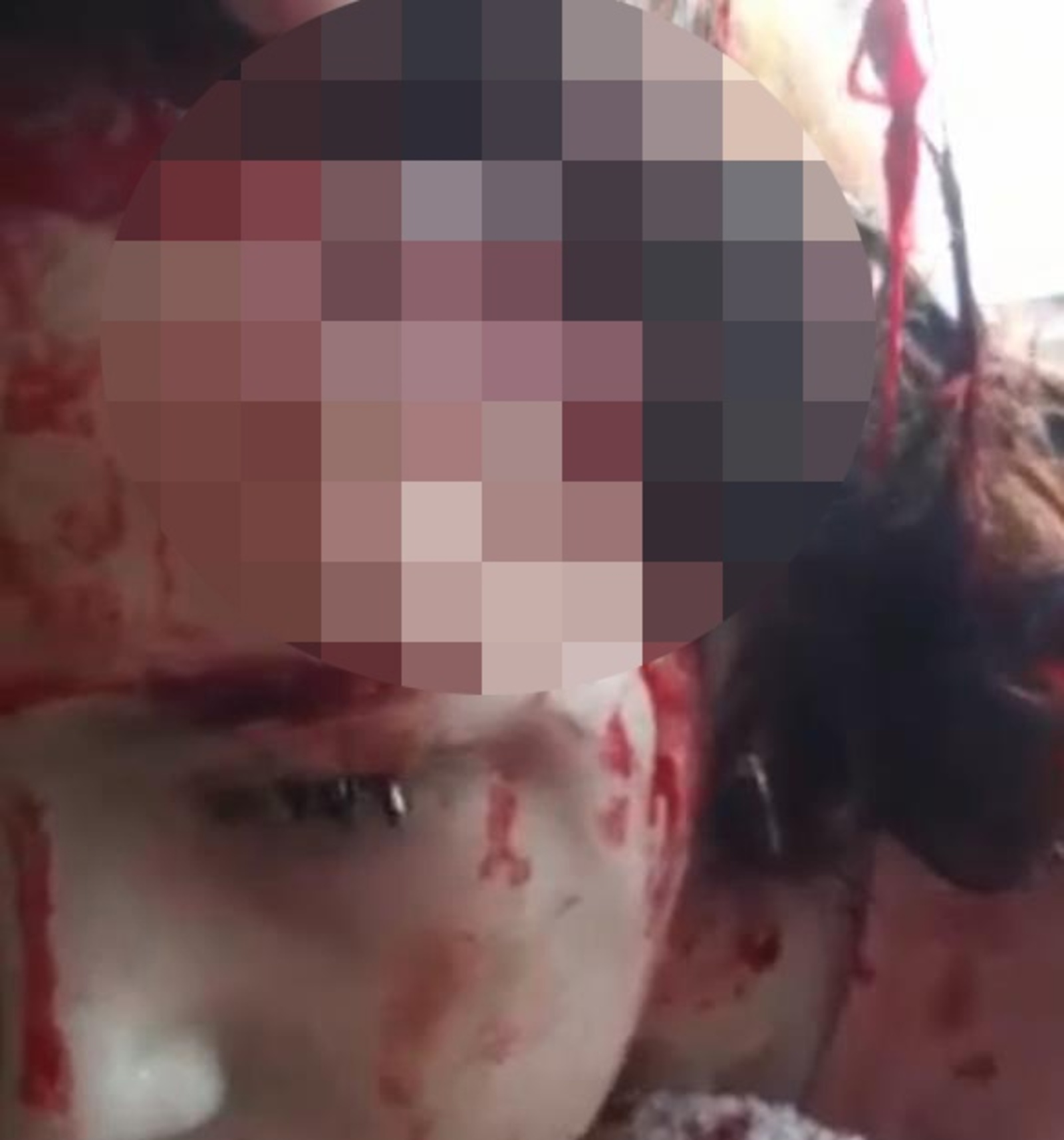 В Башкирии 10-летнюю девочку до крови покусала собака