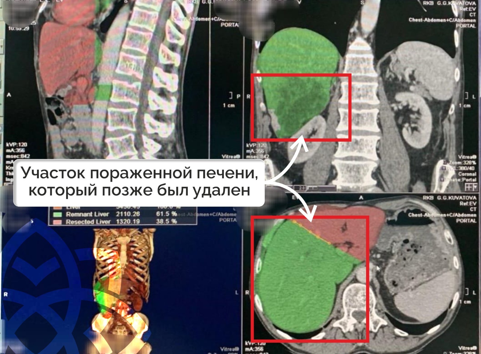 пресс-служба минздрав РБ