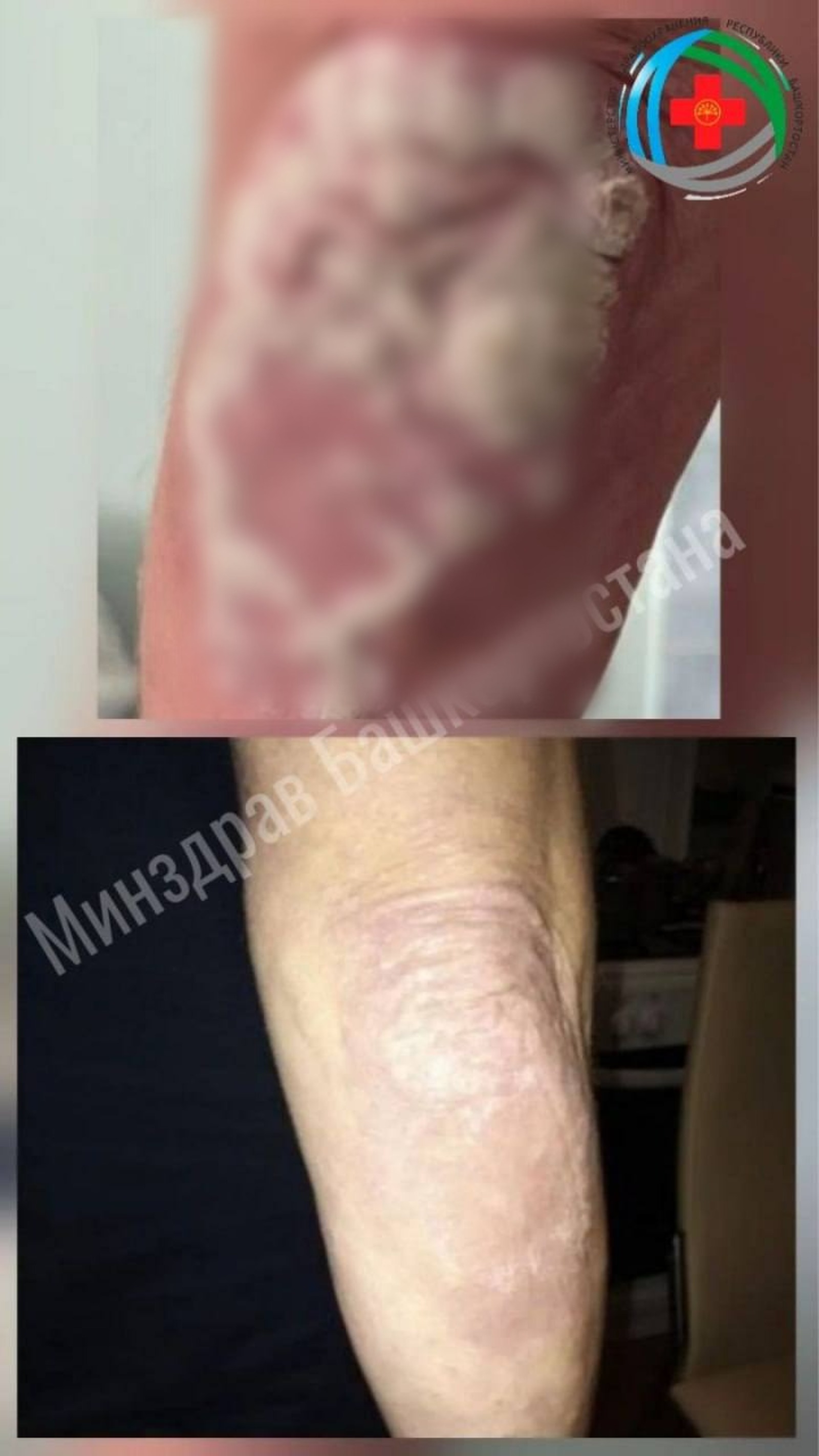 минздрав РБ пресс-служба