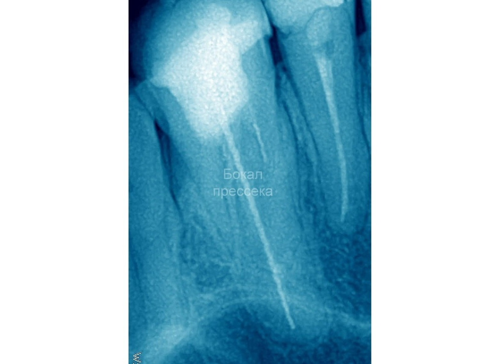 «Бокал просекка» телеграм-каналы
