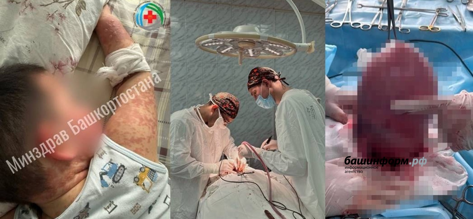 МЗ РБ, больницы республики телеграм