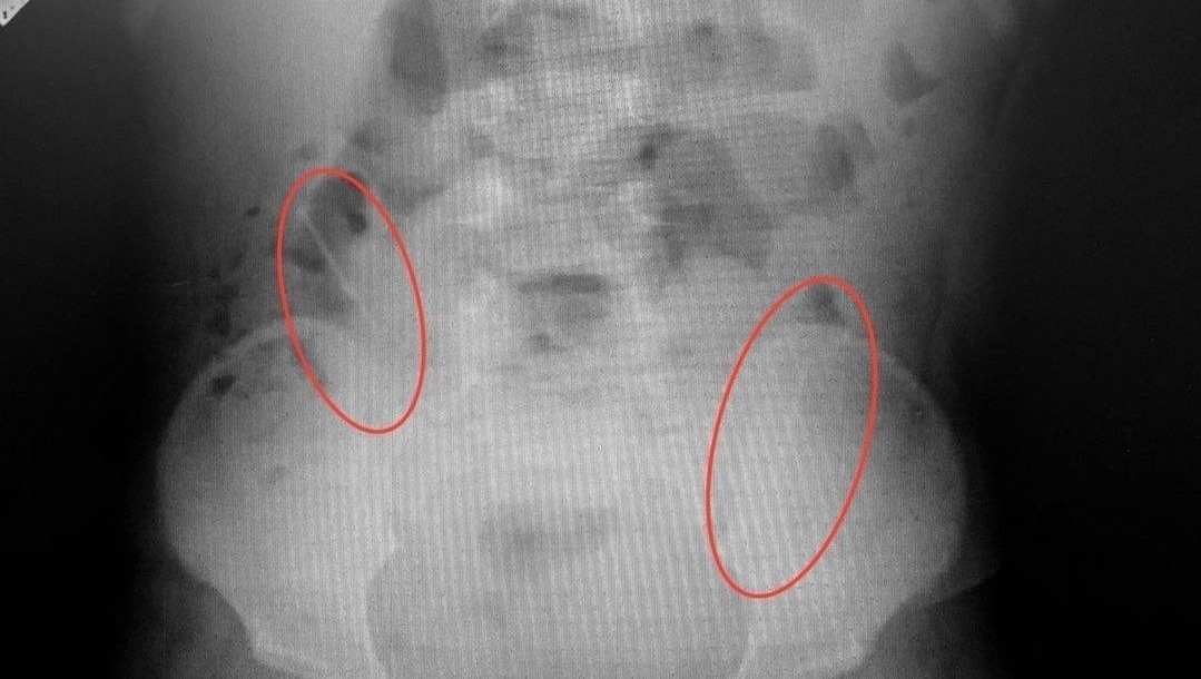 Городская детская клиническая больница №17, Vk