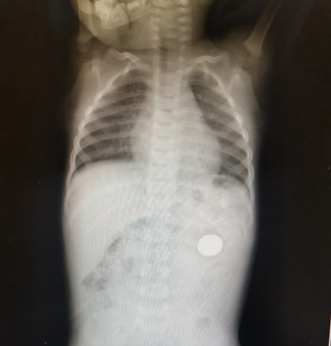 Месягутовская центральная районная больница, Vk