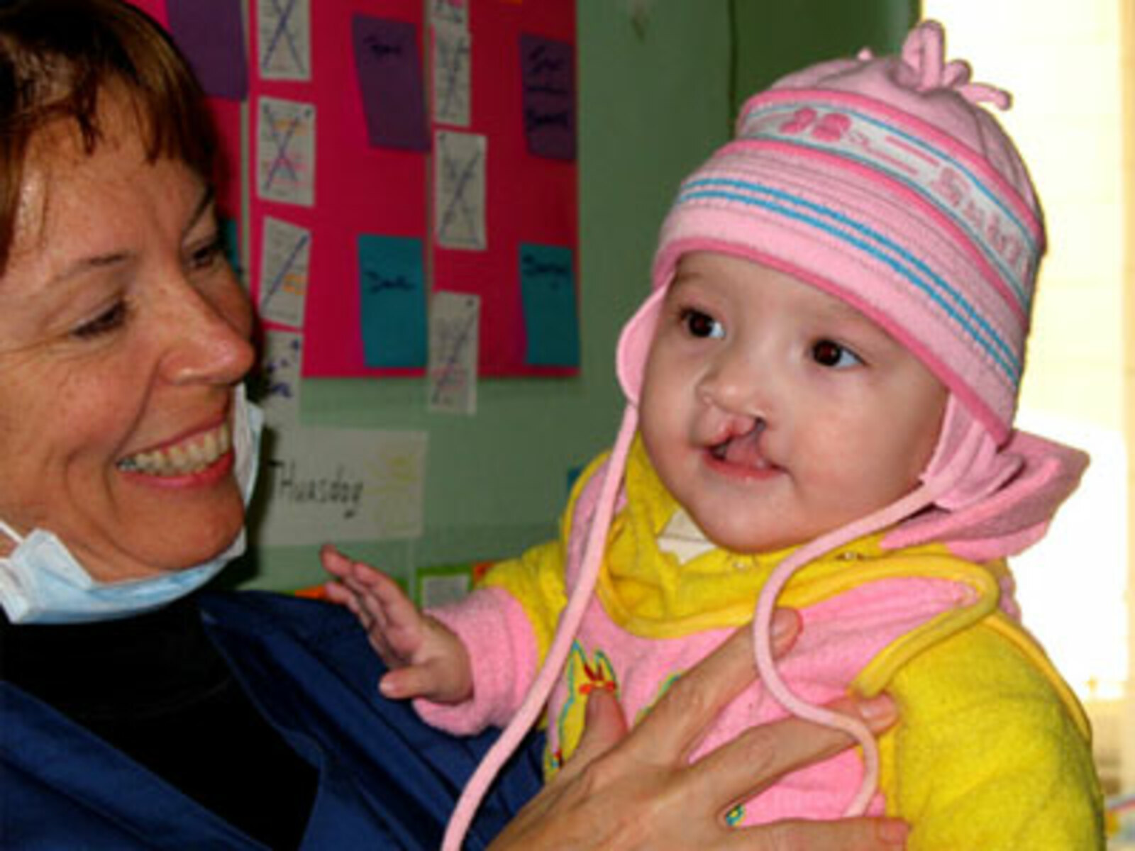 сайт operationsmile.org.ru