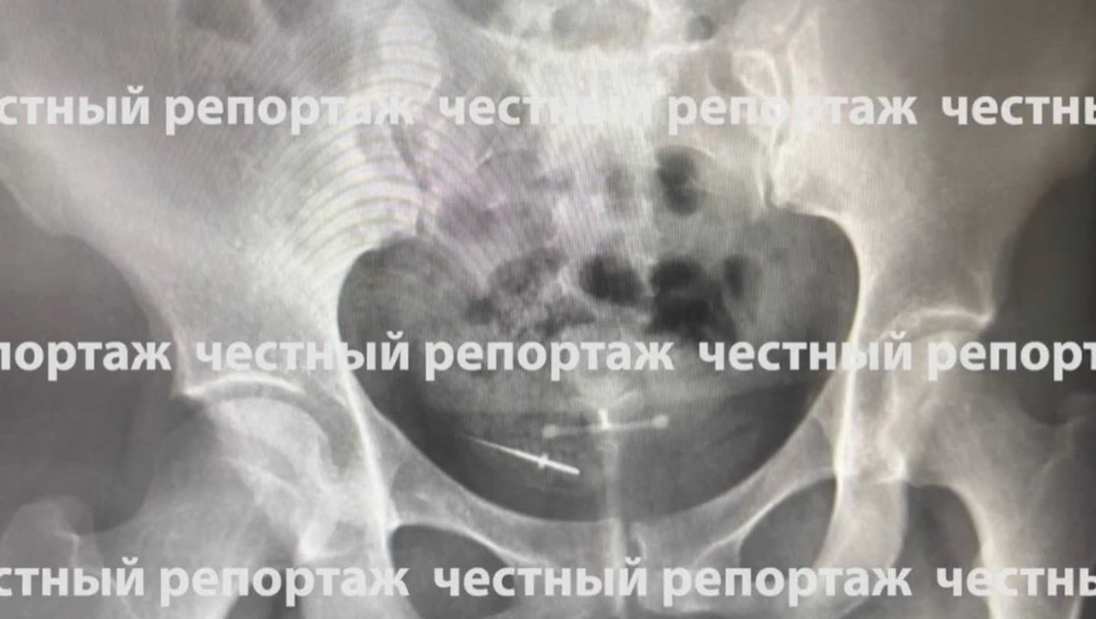 Честный репортаж, телеграм