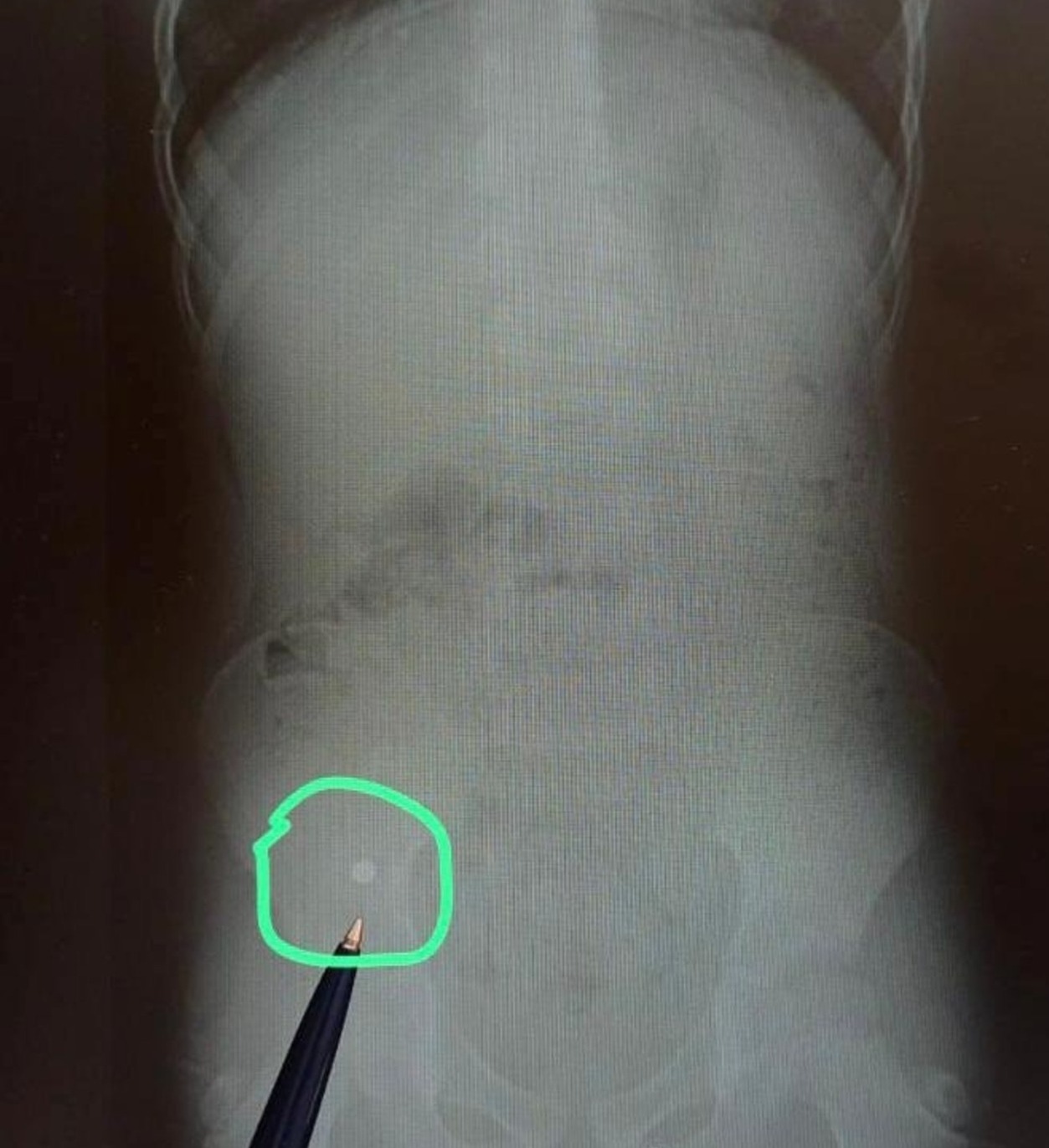 Городская детская клиническая больница №17, Vk