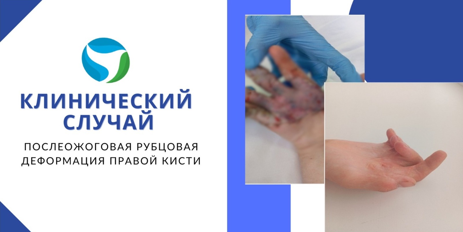 Городская клиническая больница №18 Уфы, Vk