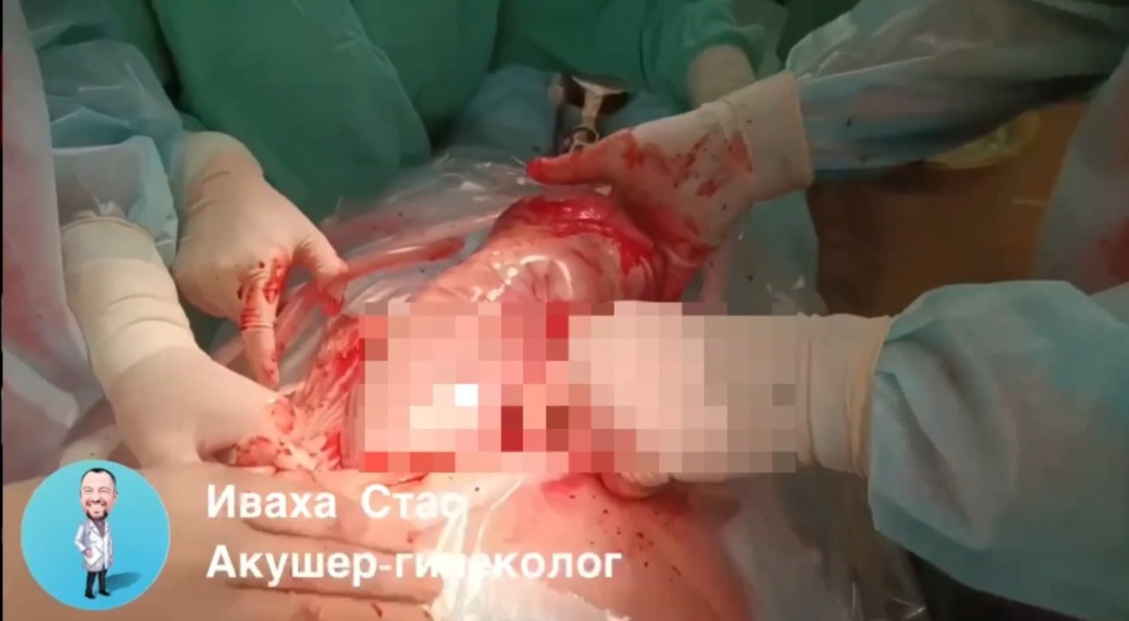 скриншот видео