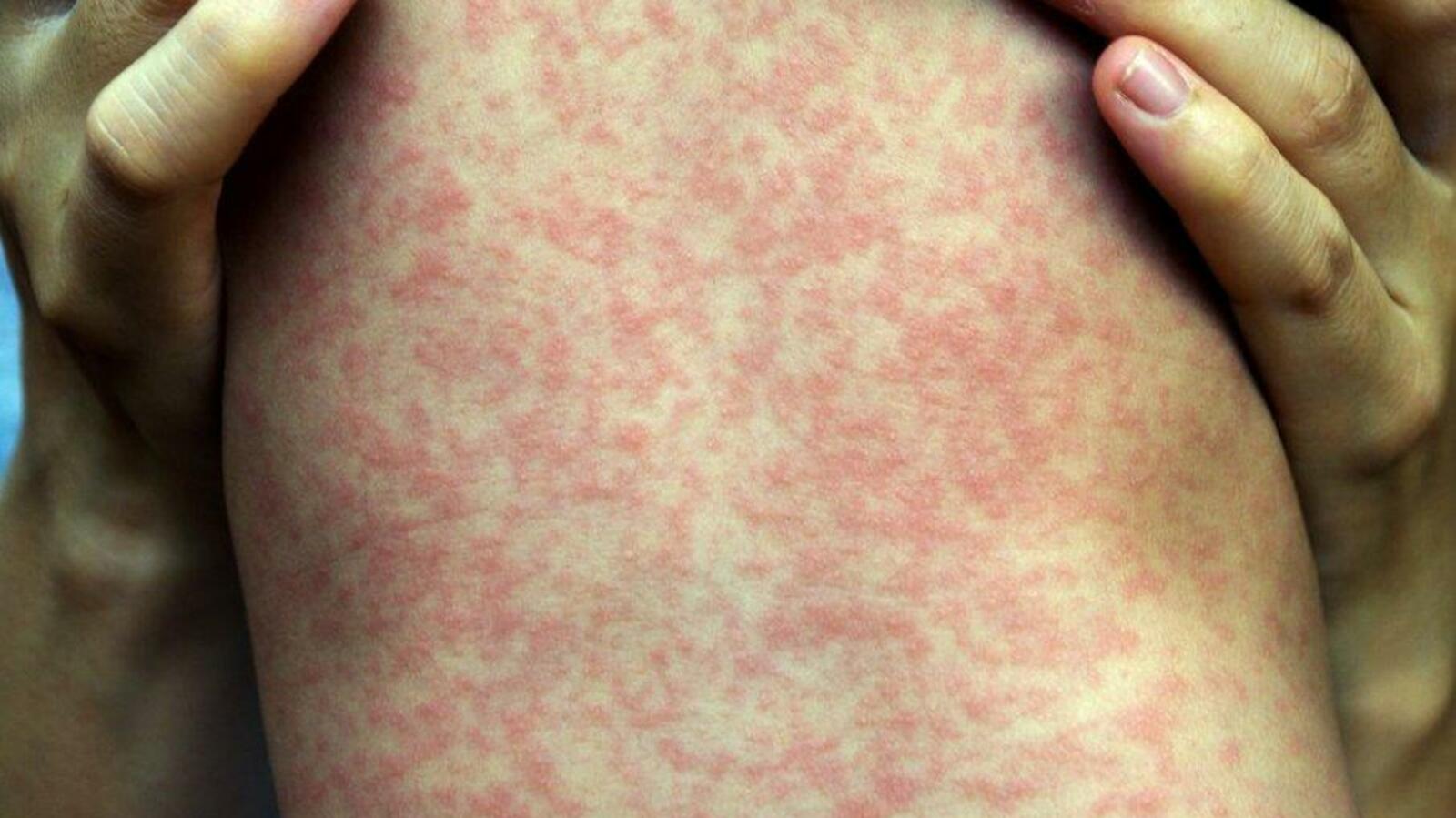 открытые источники